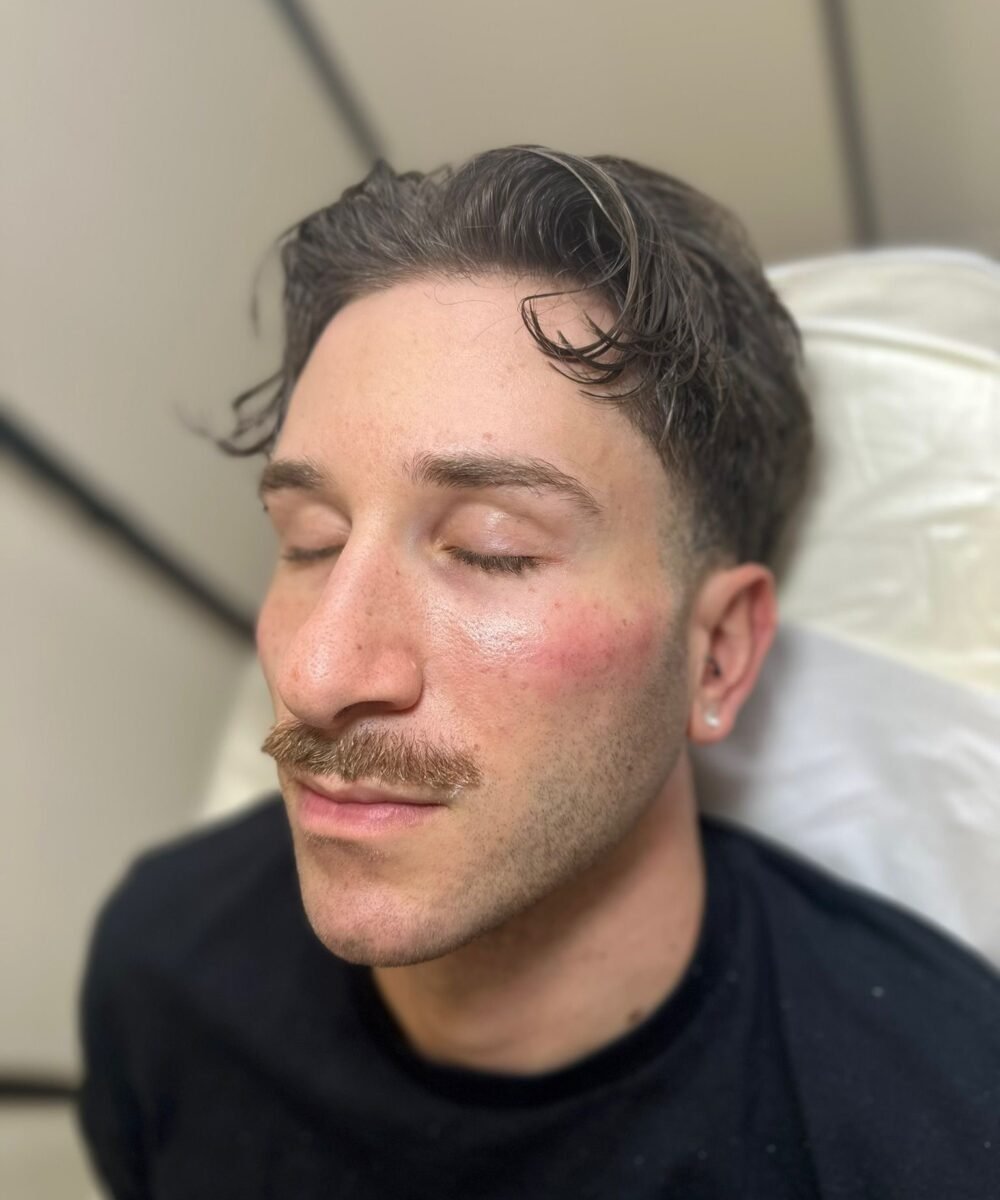 corrective treatments