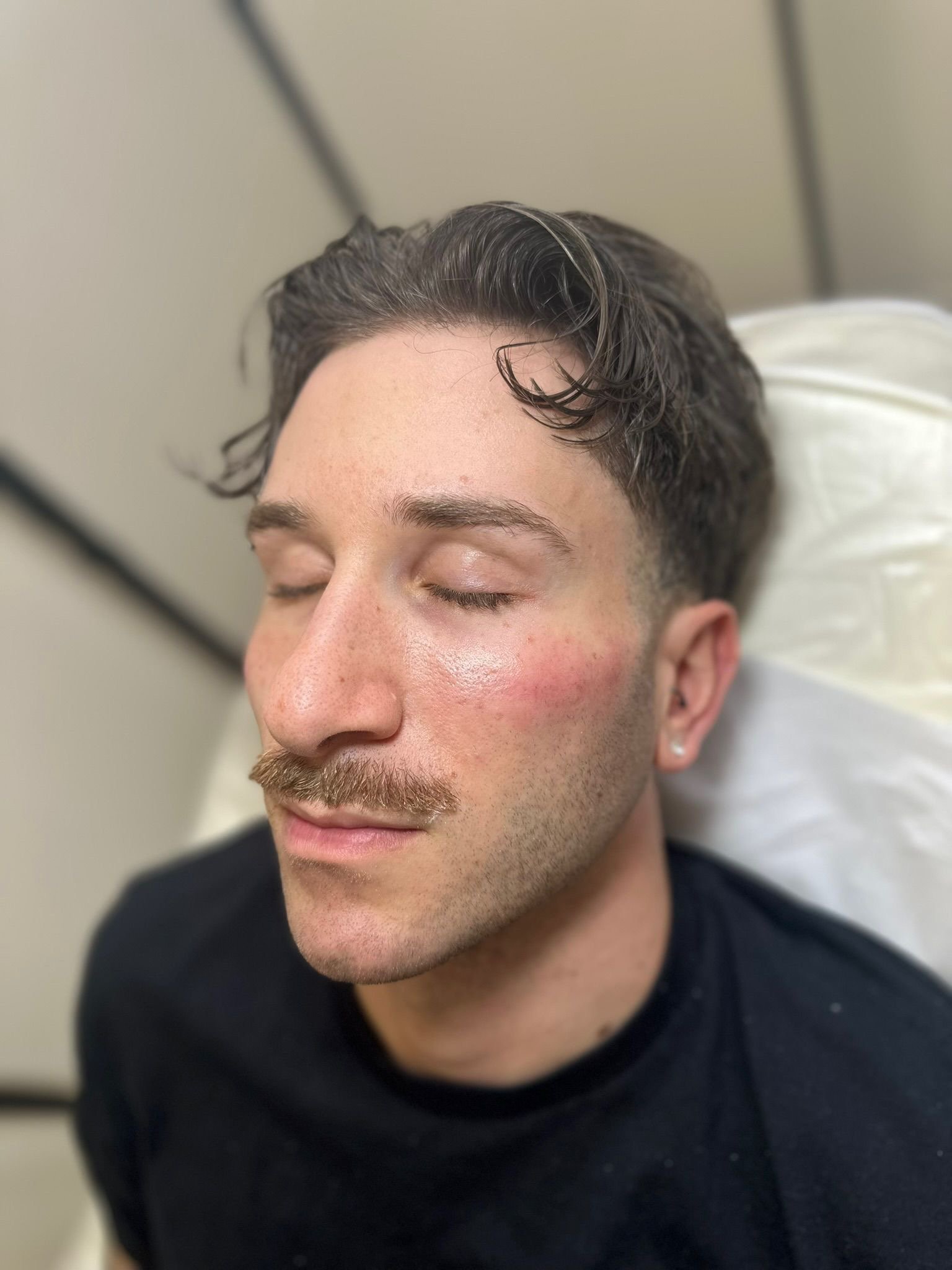 corrective treatments